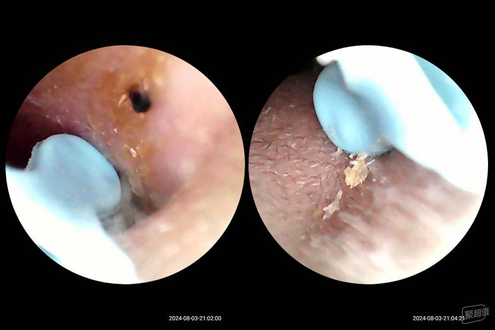 星空体育·(中国)官方网站这才是清洁耳垢的正确方法西圣Find智能可视掏耳勺评测(图14)